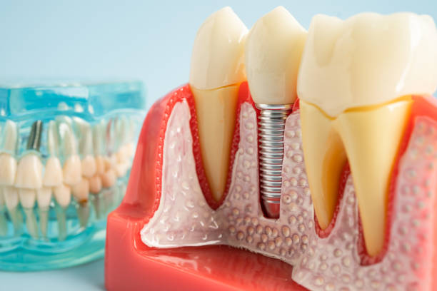 Best Dental Exams and Cleanings  in USA